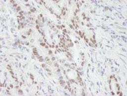 Detection of human MTA1 by immunohistochemistry.