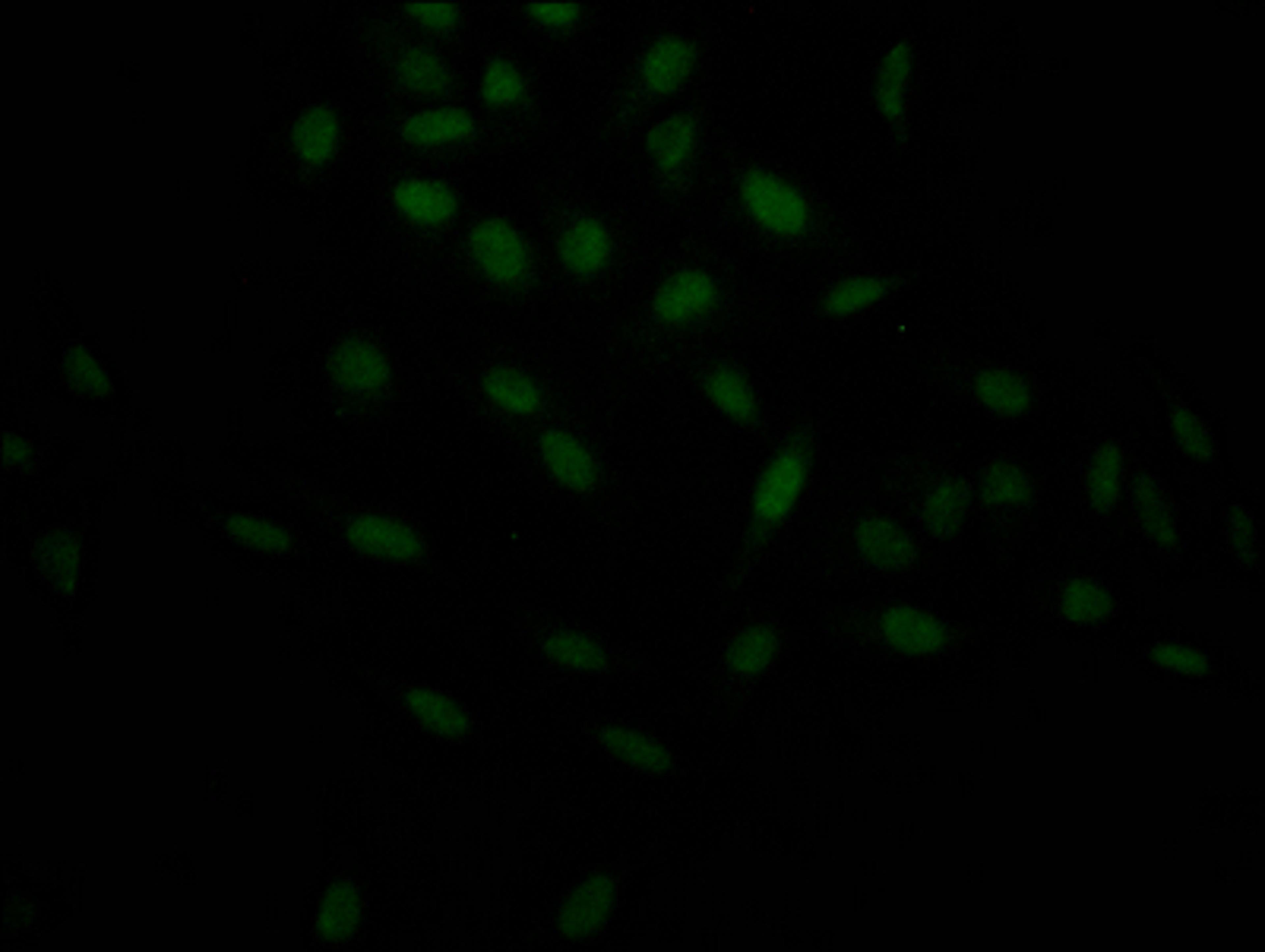 Immunofluorescence staining of Hela Cells with CSB-RA263943A0HU at 1:50, counter-stained with DAPI. The cells were fixed in 4% formaldehyde, permeated by 0.2% TritonX-100, and blocked in 10% normal Goat Serum. The cells were then incubated with the antibody overnight at 4℃. Nuclear DNA was labeled in blue with DAPI. The secondary antibody was FITC-conjugated AffiniPure Goat Anti-Rabbit IgG (H+L).