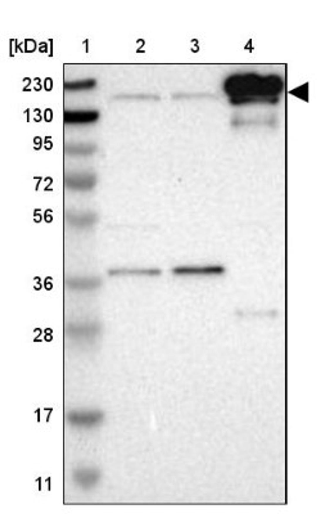 Western Blot: Attractin Antibody [NBP1-87967] - Lane 1: Marker [kDa] 230, 130, 95, 72, 56, 36, 28, 17, 11<br/>Lane 2: Human cell line RT-4<br/>Lane 3: Human cell line U-251MG sp<br/>Lane 4: Human plasma (IgG/HSA depleted)