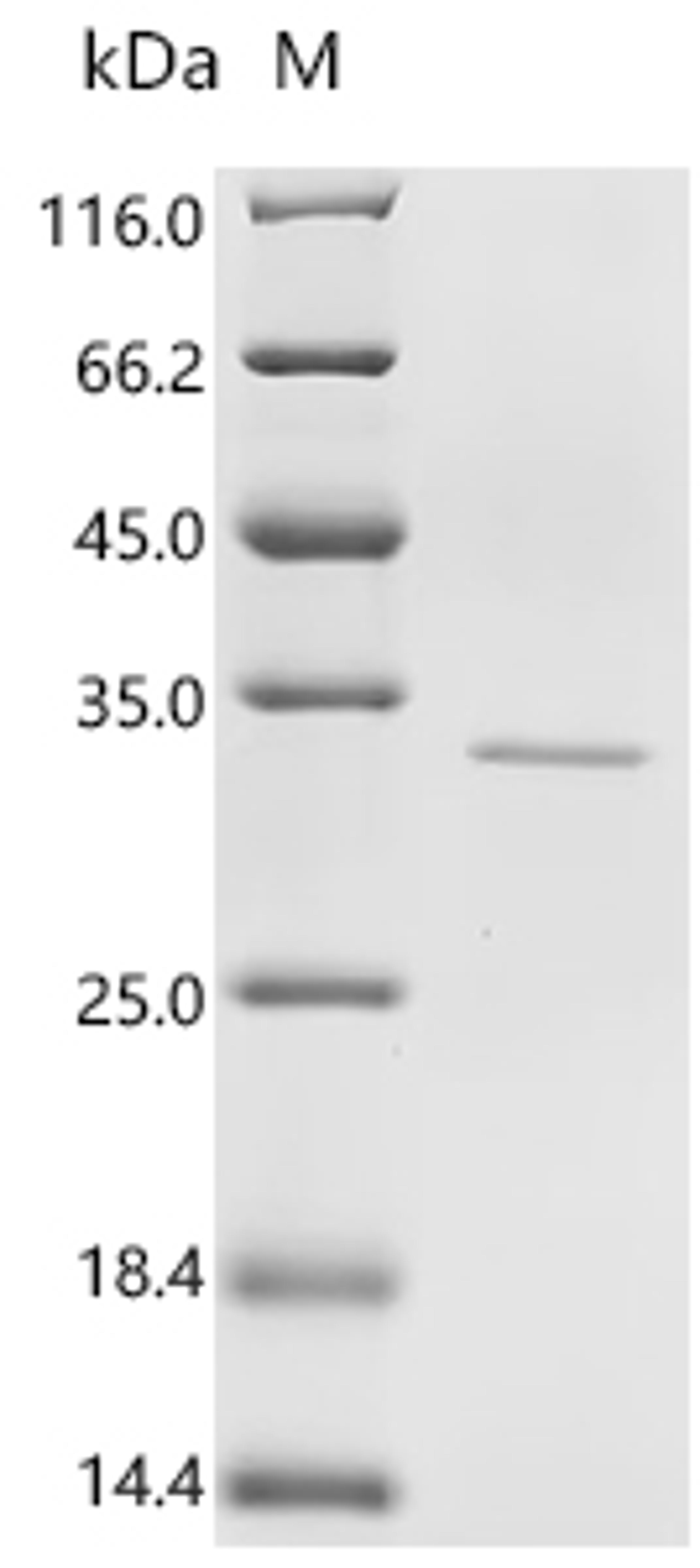 (Tris-Glycine gel) Discontinuous SDS-PAGE (reduced) with 5% enrichment gel and 15% separation gel.