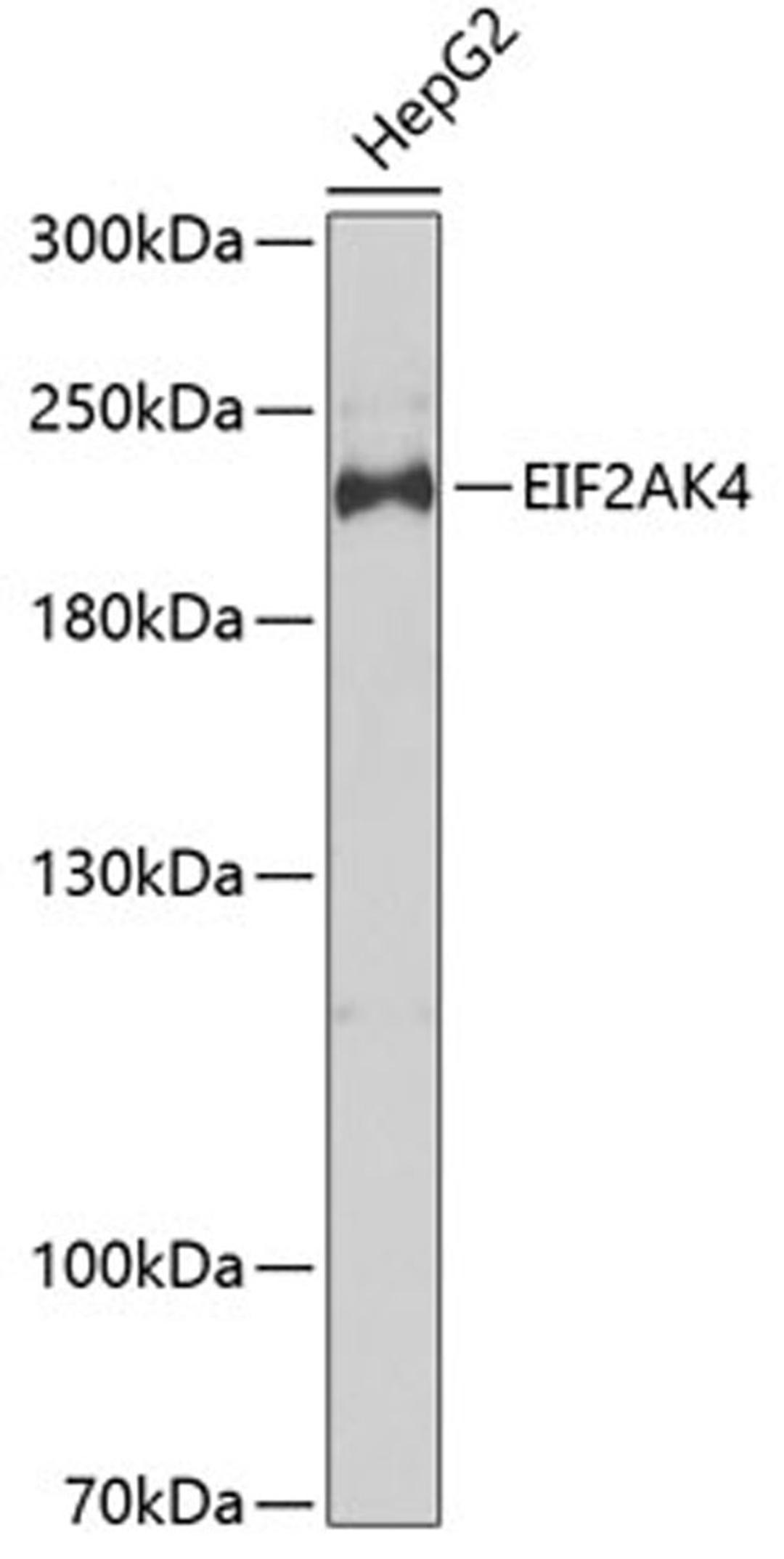 Western blot - EIF2AK4 antibody (A7155)