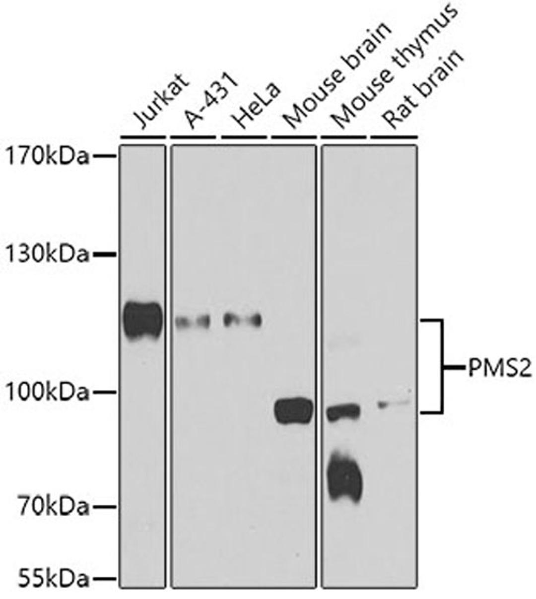 Western blot - PMS2 antibody (A6947)