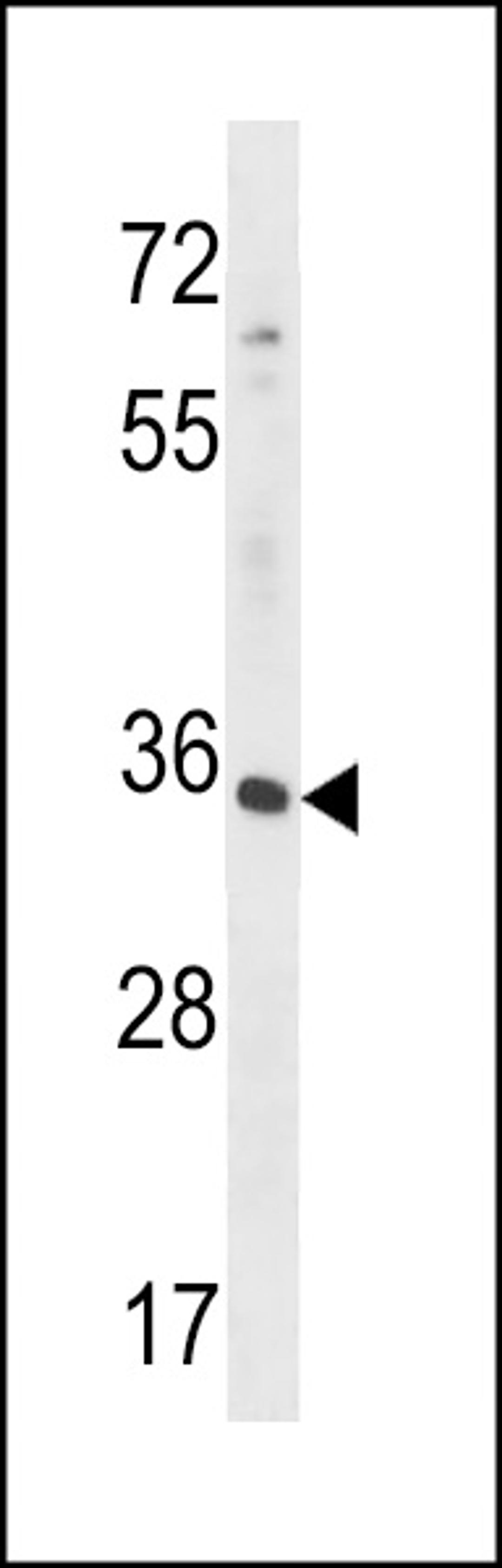 Western blot analysis in HepG2 cell line lysates (35ug/lane).