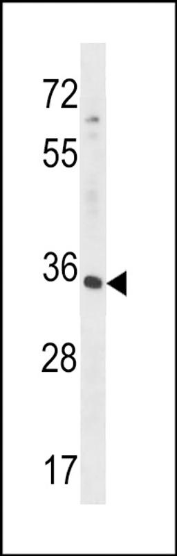 Western blot analysis in HepG2 cell line lysates (35ug/lane).