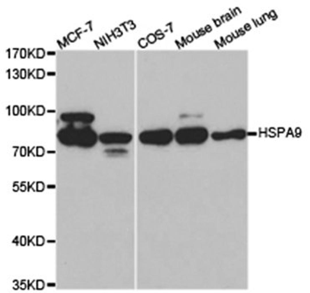 Western blot analysis of various cell lines using HSPA9 antibody.