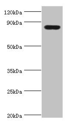 Western blot. All lanes: Peroxisomal multifunctional enzyme type 2 antibody at 3ug/ml + Mouse liver tissue. Secondary. Goat polyclonal to rabbit IgG at 1/10000 dilution. Predicted band size: 80, 84, 78 kDa. Observed band size: 80 kDa.