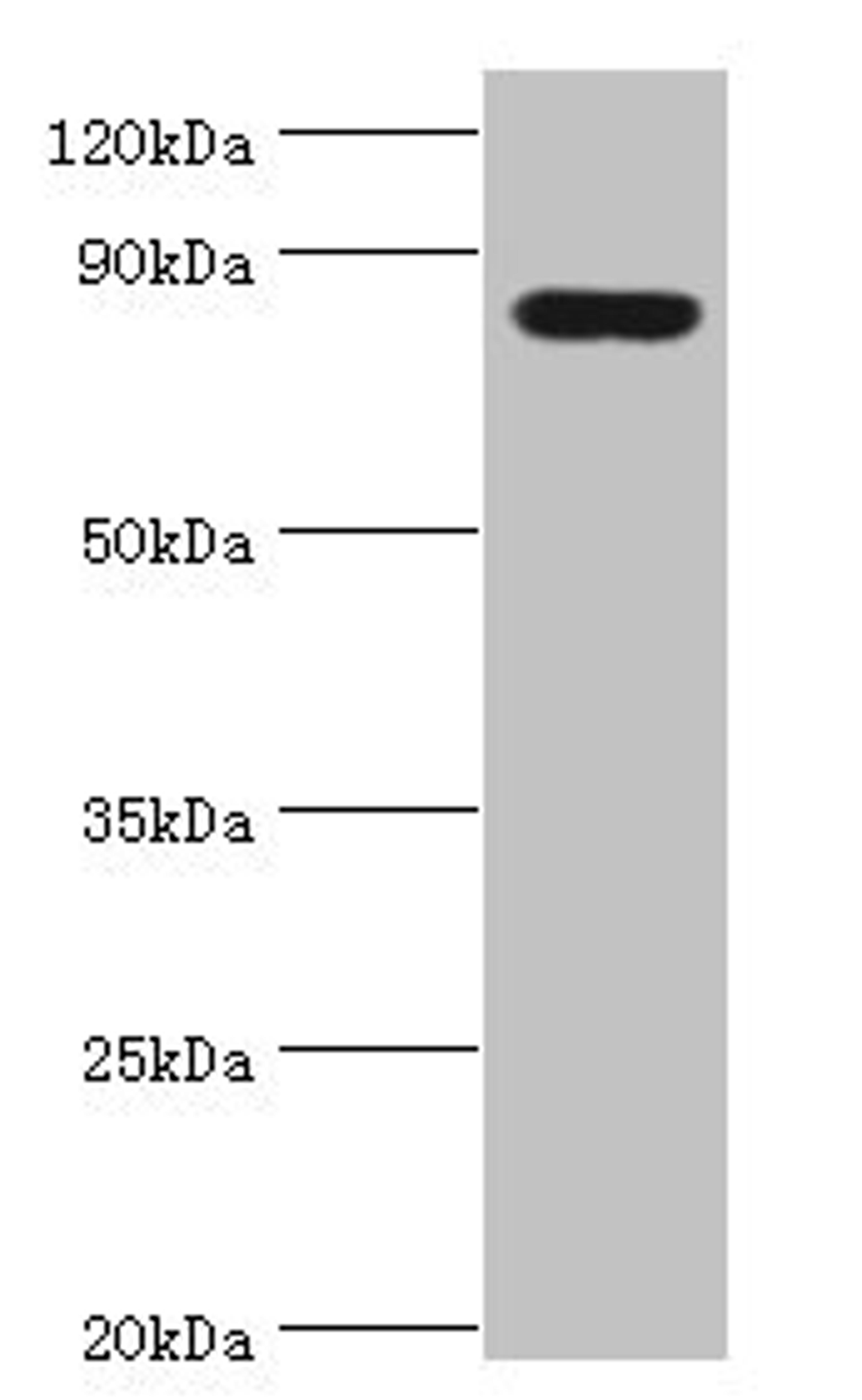 Western blot. All lanes: Peroxisomal multifunctional enzyme type 2 antibody at 3ug/ml + Mouse liver tissue. Secondary. Goat polyclonal to rabbit IgG at 1/10000 dilution. Predicted band size: 80, 84, 78 kDa. Observed band size: 80 kDa.