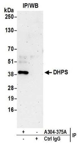 Detection of human DHPS by western blot of immunoprecipitates.