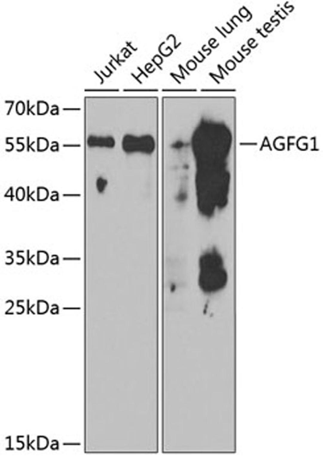 Western blot - AGFG1 antibody (A6294)