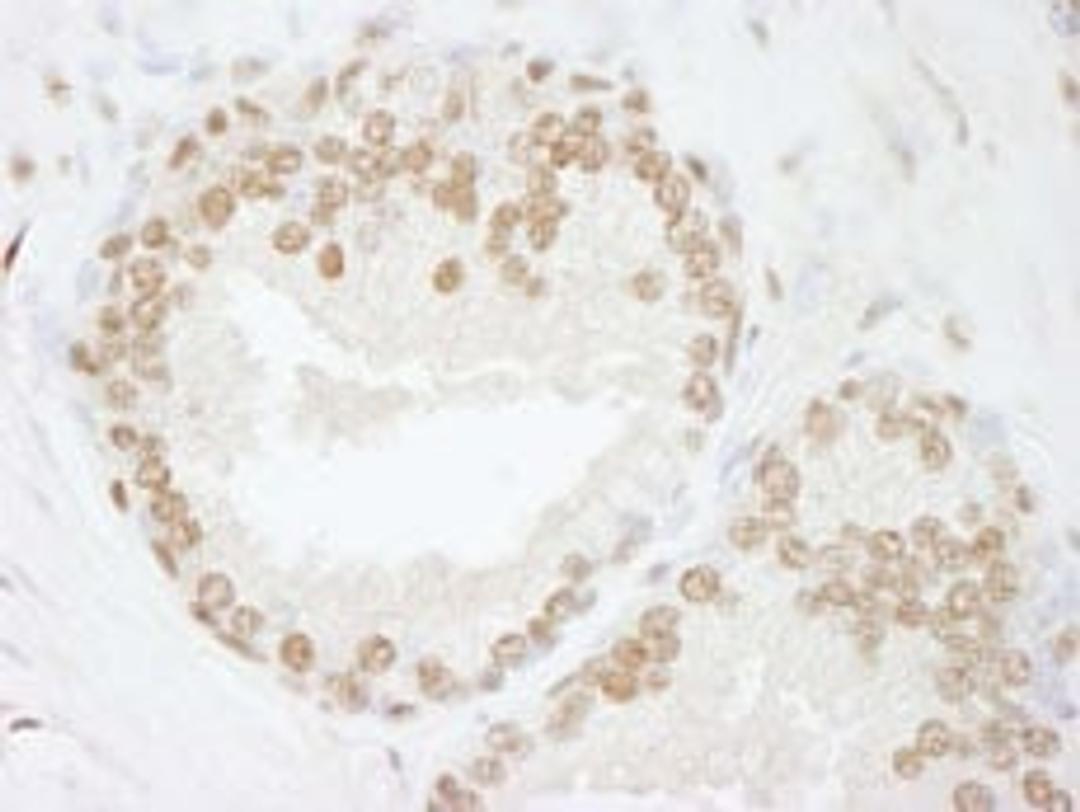 Detection of human SMARCC2/BAF170 by immunohistochemistry.