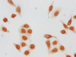 Immunocytochemistry analysis of CSB-PA010418PA79forHU diluted at 1:20 and staining in Hela cells(treated with 30mM sodium butyrate for 4h) performed on a Leica BondTM system. The cells were fixed in 4% formaldehyde, permeabilized using 0.2% Triton X-100 and blocked with 10% normal goat serum 30min at RT. Then primary antibody (1% BSA) was incubated at 4°C overnight. The primary is detected by a biotinylated secondary antibody and visualized using an HRP conjugated SP system.