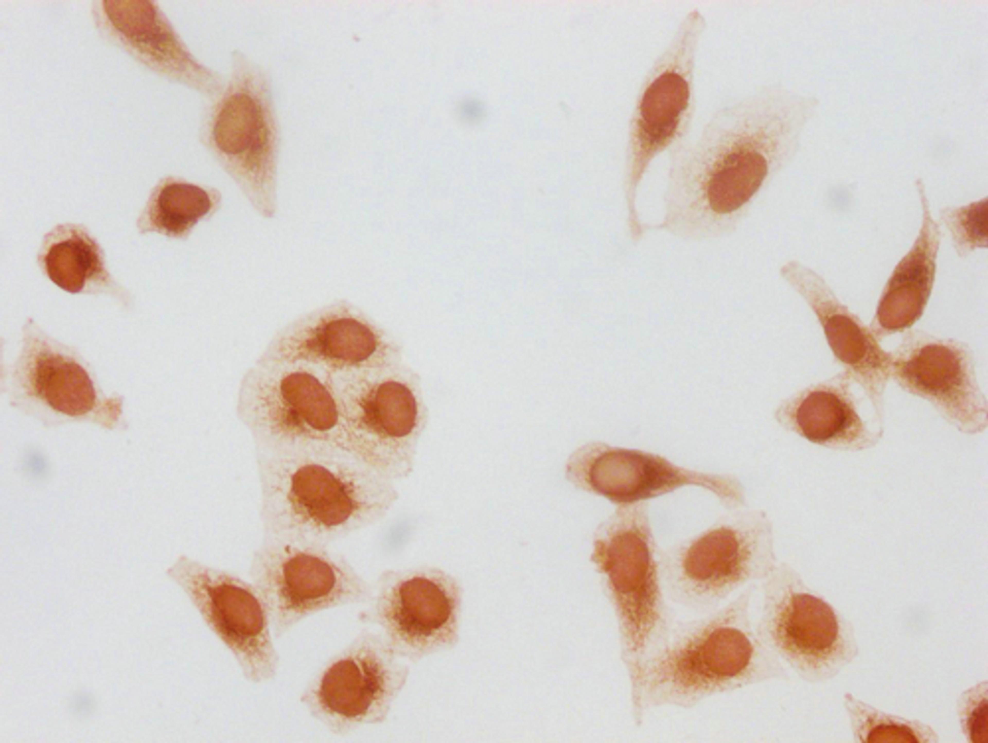 Immunocytochemistry analysis of CSB-PA010418PA79forHU diluted at 1:20 and staining in Hela cells(treated with 30mM sodium butyrate for 4h) performed on a Leica BondTM system. The cells were fixed in 4% formaldehyde, permeabilized using 0.2% Triton X-100 and blocked with 10% normal goat serum 30min at RT. Then primary antibody (1% BSA) was incubated at 4°C overnight. The primary is detected by a biotinylated secondary antibody and visualized using an HRP conjugated SP system.