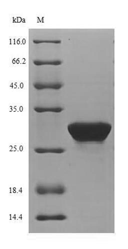 (Tris-Glycine gel) Discontinuous SDS-PAGE (reduced) with 5% enrichment gel and 15% separation gel.