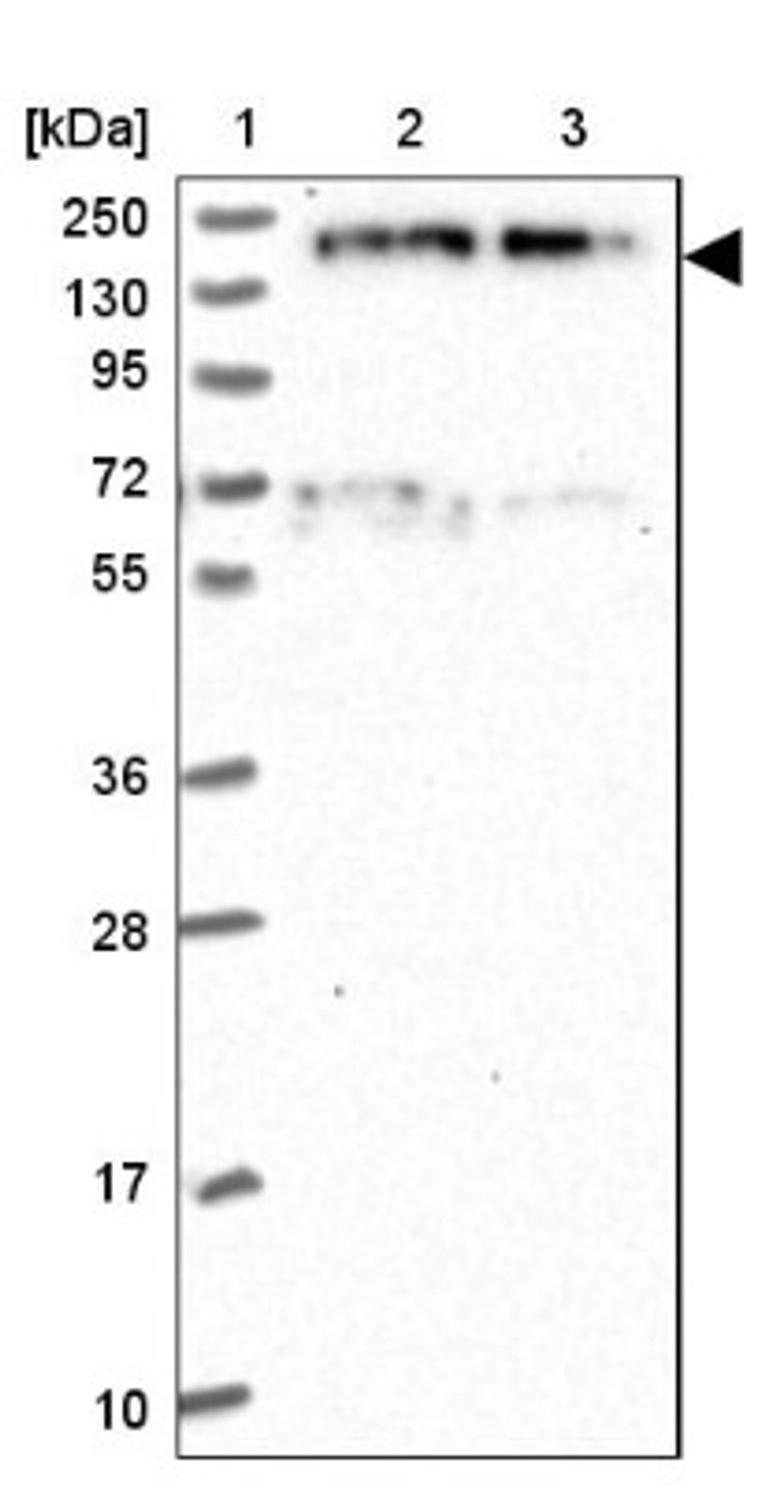 Western Blot: EDC4 Antibody [NBP2-13944] - Lane 1: Marker [kDa] 250, 130, 95, 72, 55, 36, 28, 17, 10<br/>Lane 2: Human cell line RT-4<br/>Lane 3: Human cell line U-251MG sp