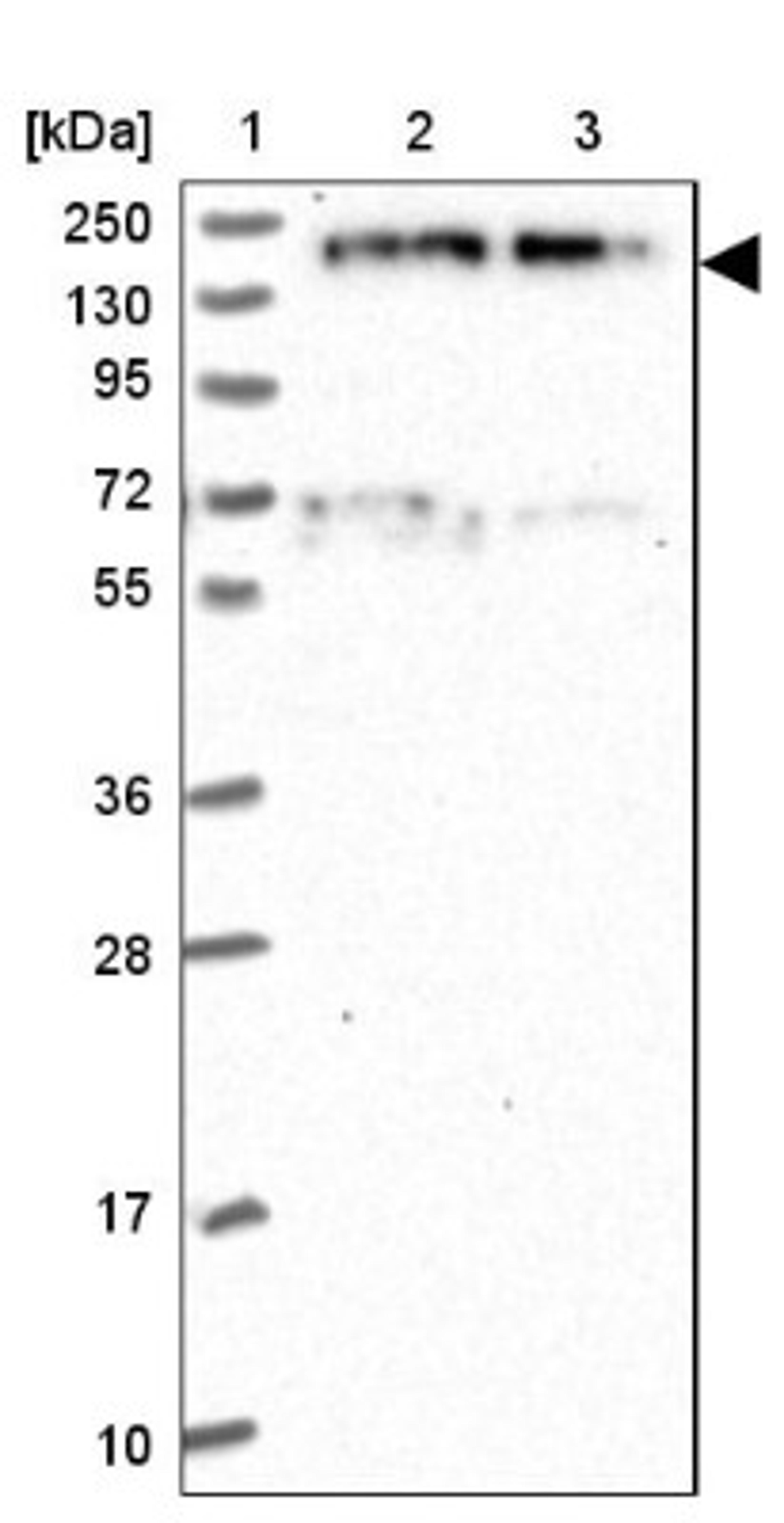 Western Blot: EDC4 Antibody [NBP2-13944] - Lane 1: Marker [kDa] 250, 130, 95, 72, 55, 36, 28, 17, 10<br/>Lane 2: Human cell line RT-4<br/>Lane 3: Human cell line U-251MG sp