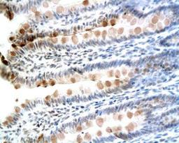 Immunohistochemical analysis of paraffin-embedded rat colon tissue using CCK8 antibody