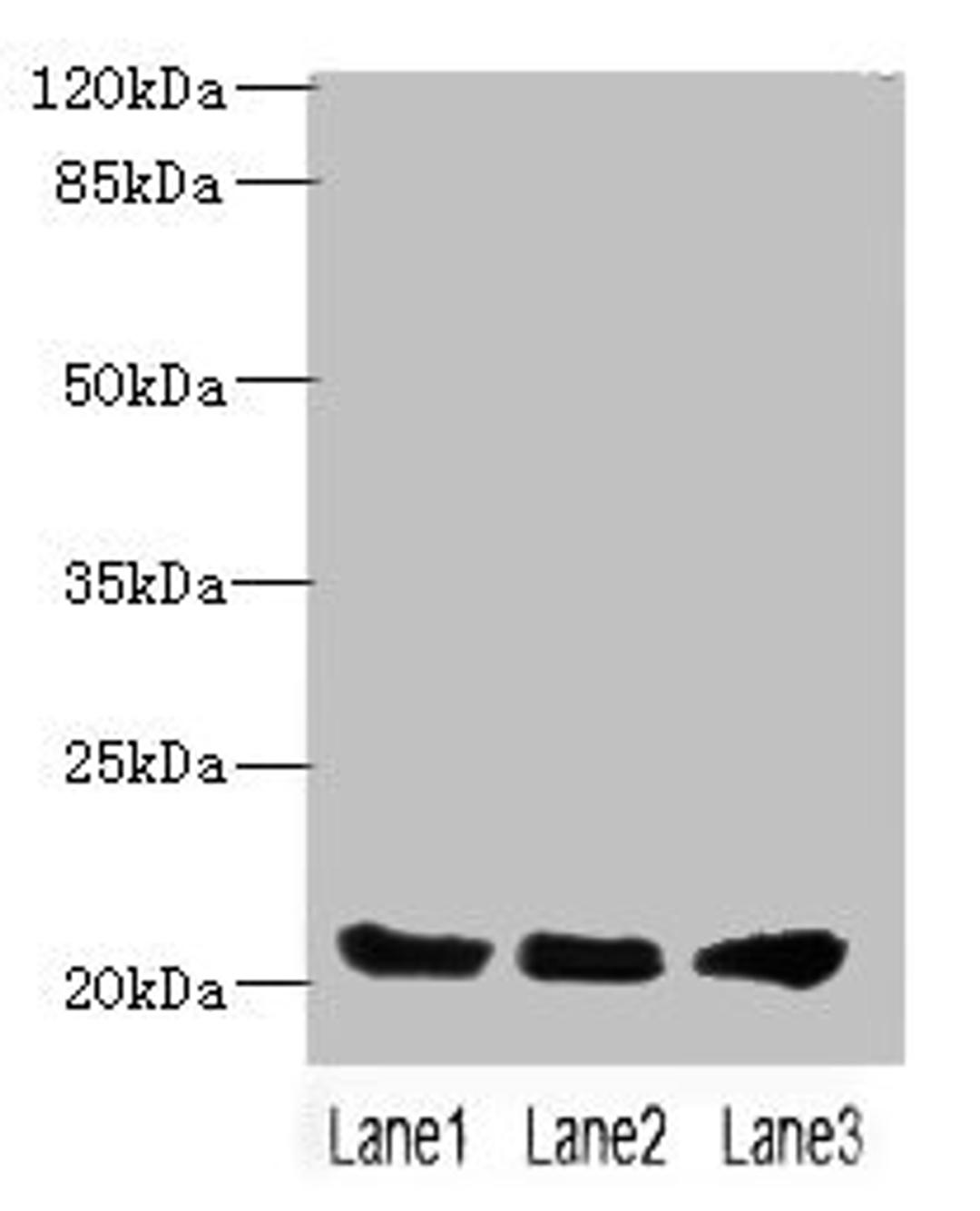 Western blot. All lanes: PLLP antibody at 4ug/ml. Lane 1: Mouse gonadal tissue. Lane 2: Mouse kidney tissue. Lane 3: Mouse lung tissue. Secondary. Goat polyclonal to rabbit IgG at 1/10000 dilution. Predicted band size: 20 kDa. Observed band size: 20 kDa. 