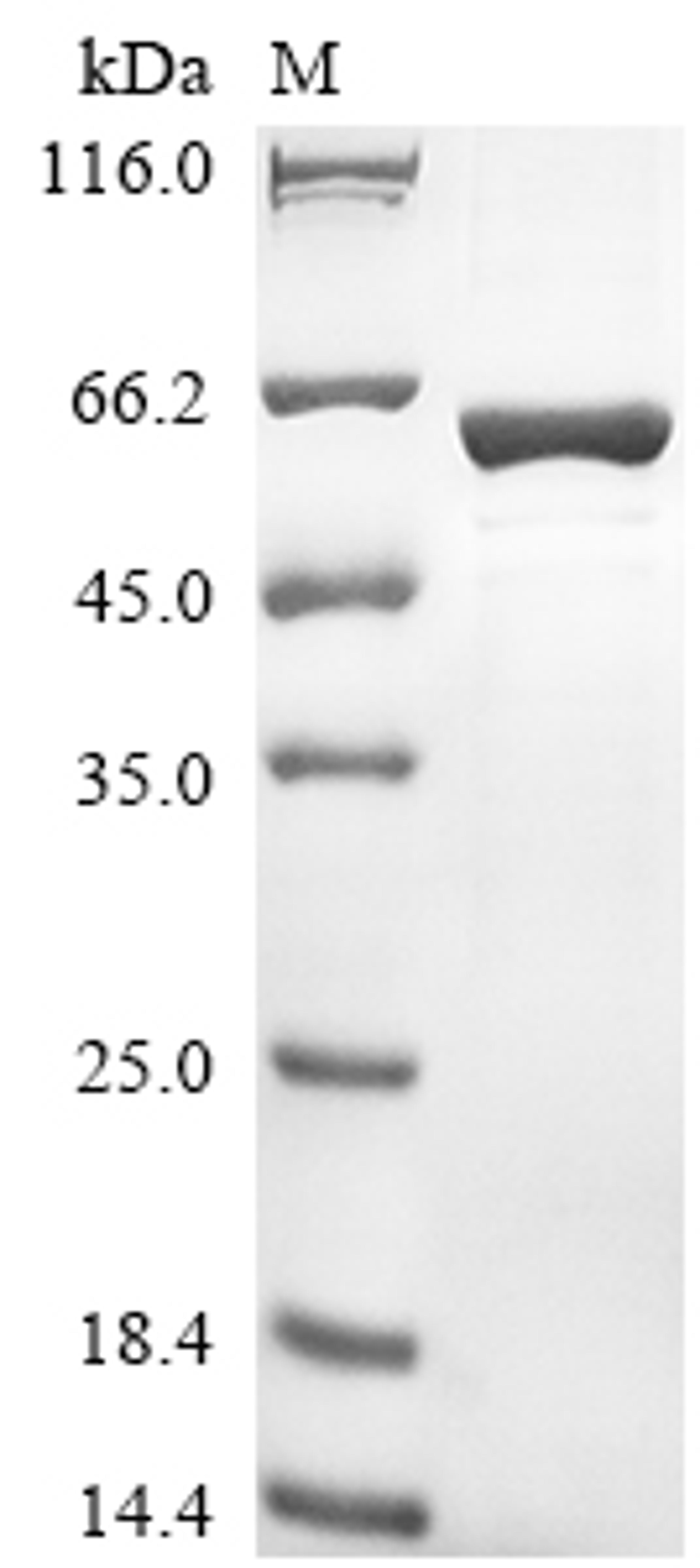 (Tris-Glycine gel) Discontinuous SDS-PAGE (reduced) with 5% enrichment gel and 15% separation gel.