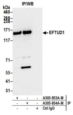 Detection of human EFTUD1 by WB of IP.