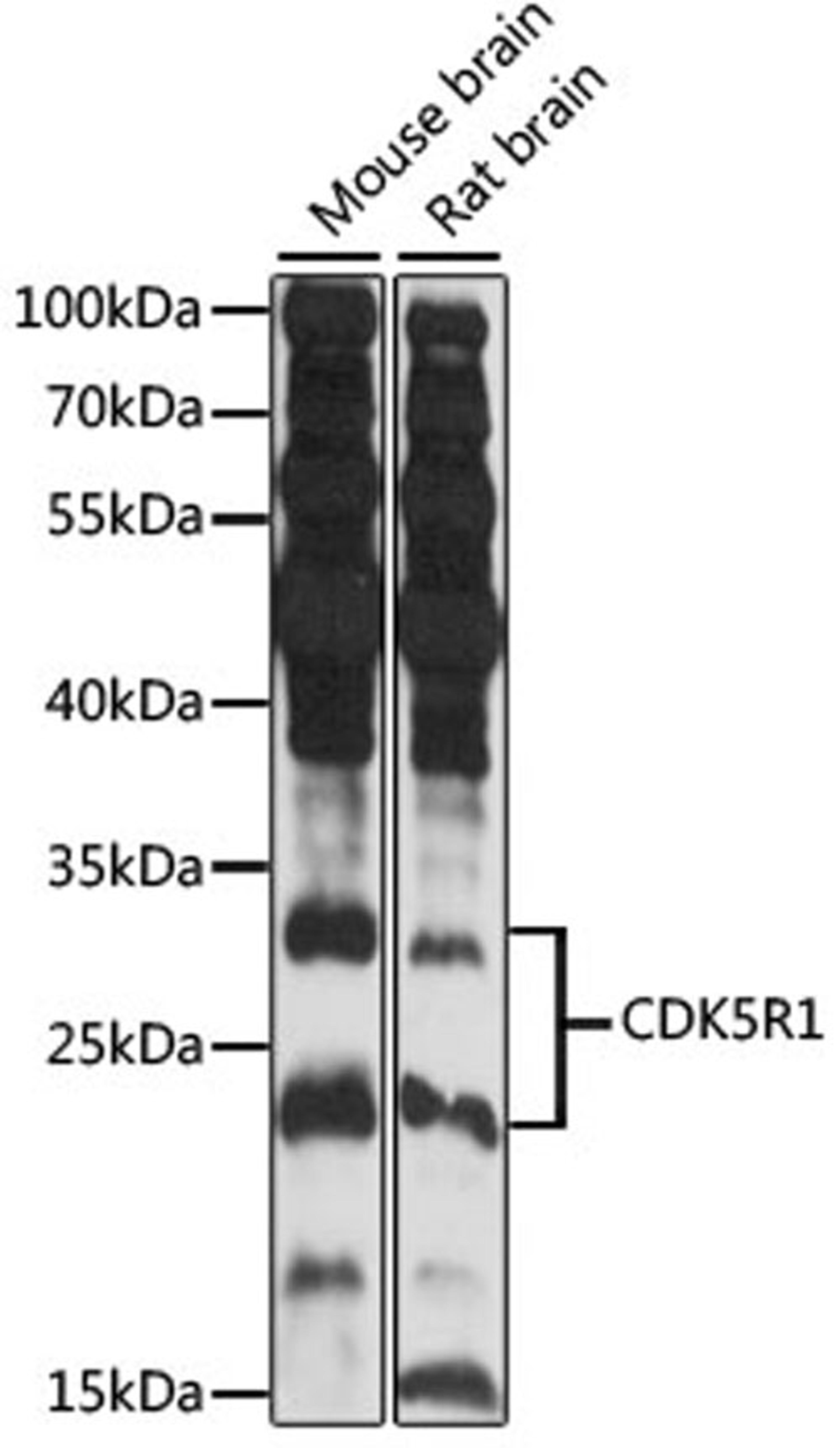 Western blot - CDK5R1 antibody (A14497)