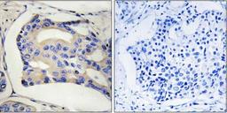 Western blot analysis of Jurkat cells using STK32C antibody.