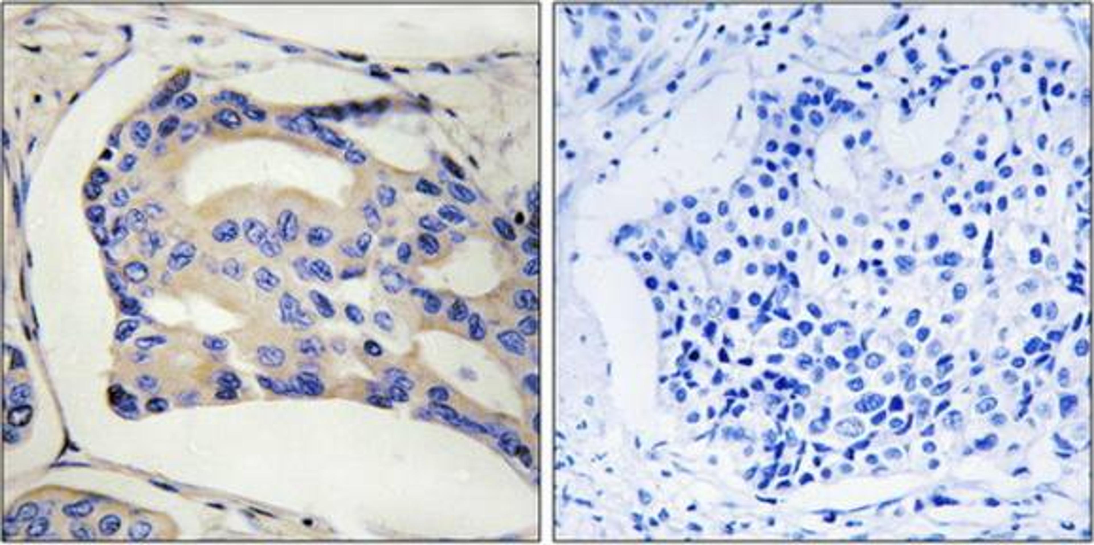 Western blot analysis of Jurkat cells using STK32C antibody.