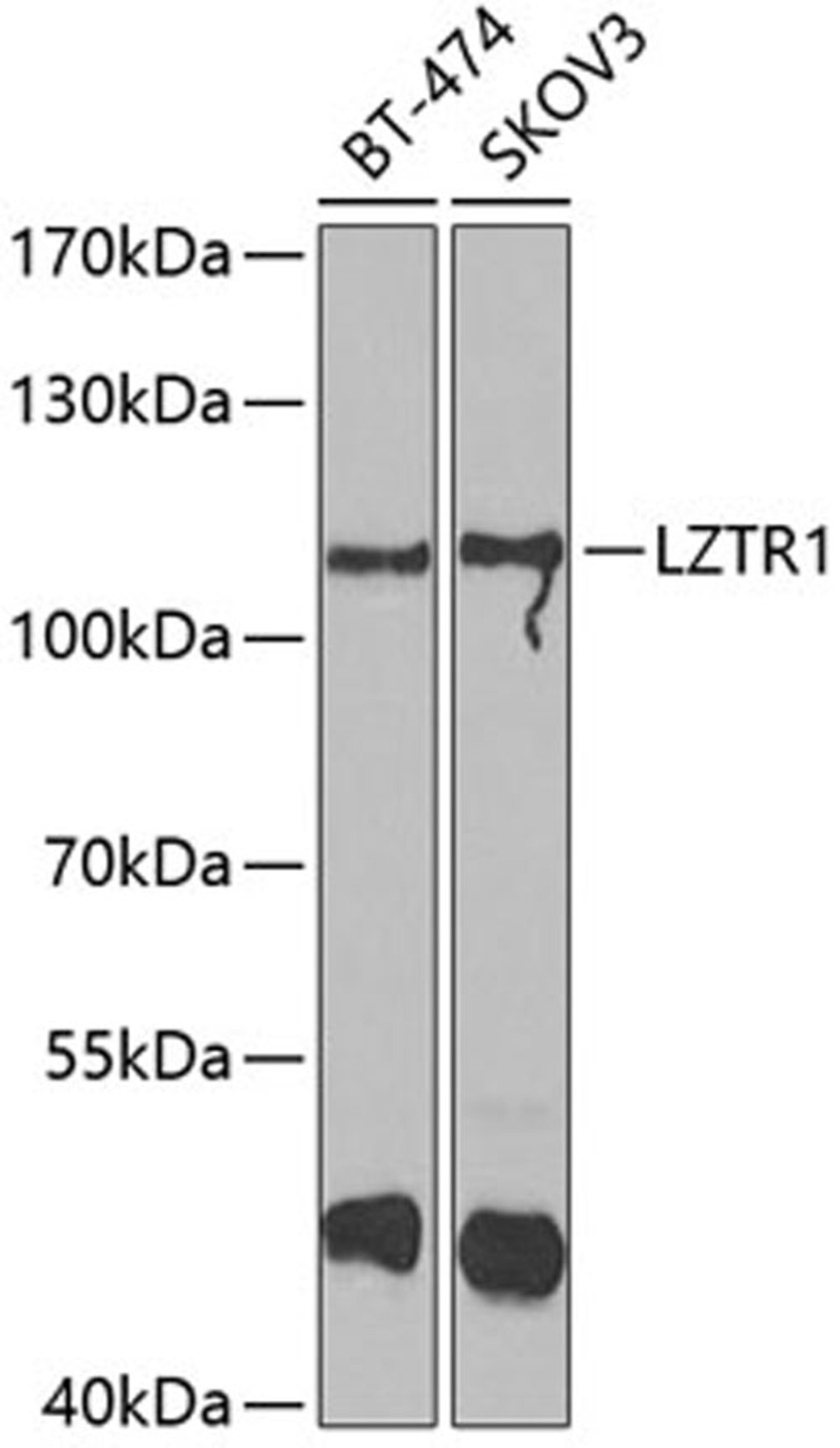 Western blot - LZTR1 antibody (A7350)