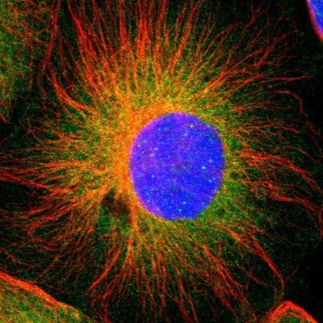 Immunocytochemistry/Immunofluorescence: INF2 Antibody [NBP1-88414] - Staining of human cell line U-251MG shows positivity in nucleus & cytoplasm.