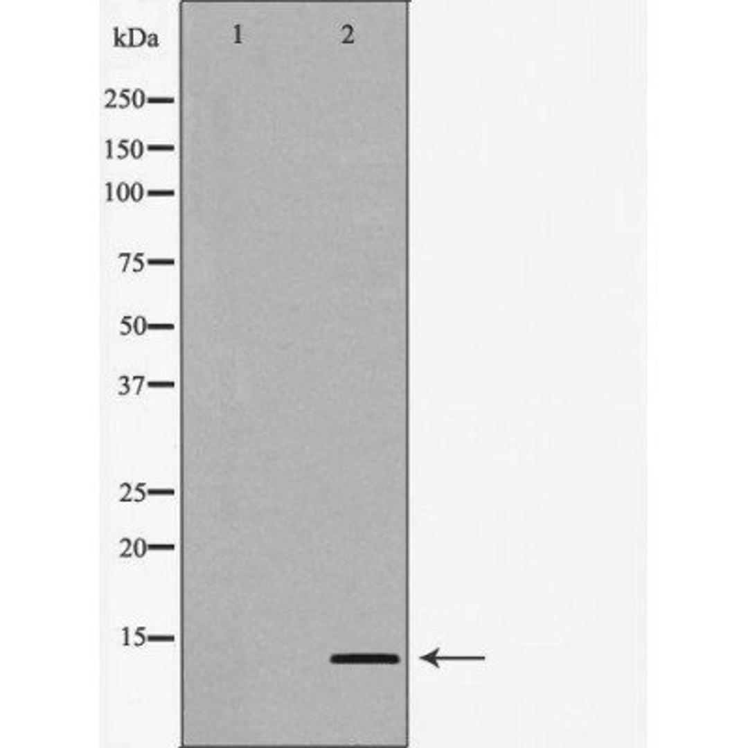 Western blot analysis of Jurkat cell line using CCL24 antibody