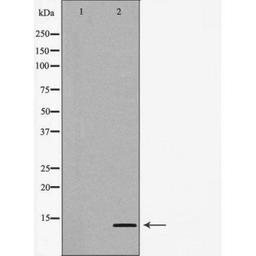 Western blot analysis of Jurkat cell line using CCL24 antibody