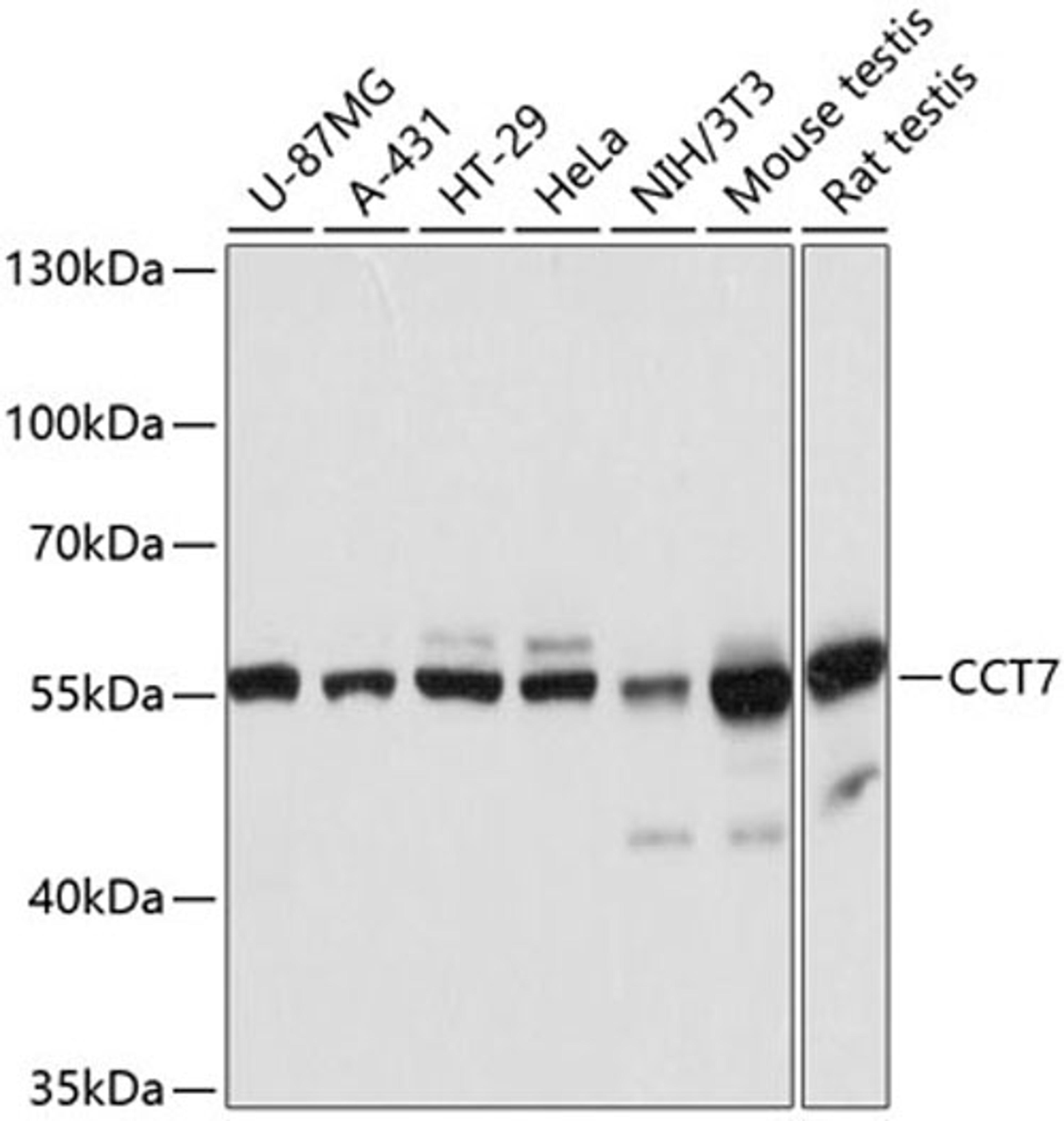 Western blot - CCT7 antibody (A12146)