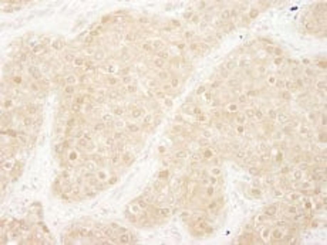 Detection of human ERK1 by immunohistochemistry.