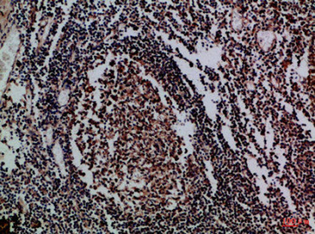 Immunohistochemical analysis of paraffin-embedded Human-tonsil, antibody was diluted at 1:100