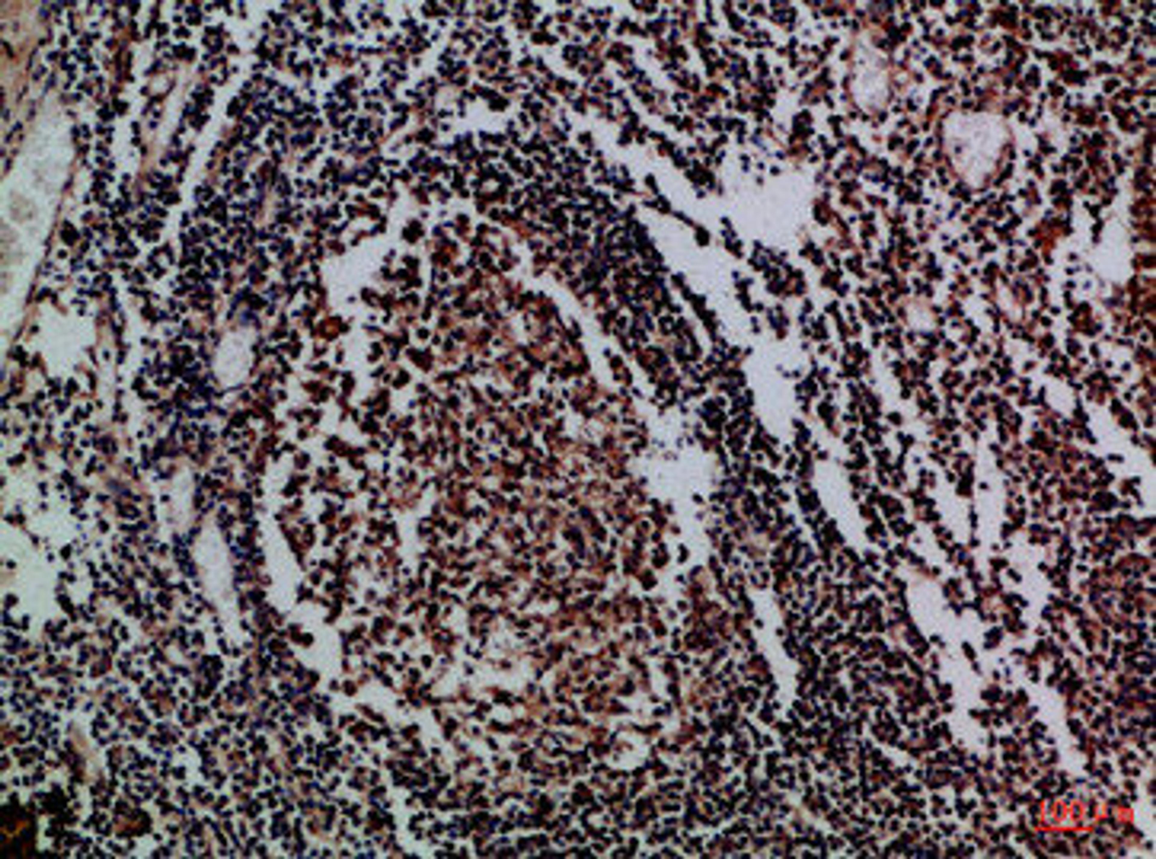 Immunohistochemical analysis of paraffin-embedded Human-tonsil, antibody was diluted at 1:100