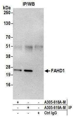 Detection of human FAHD1 by WB of IP.