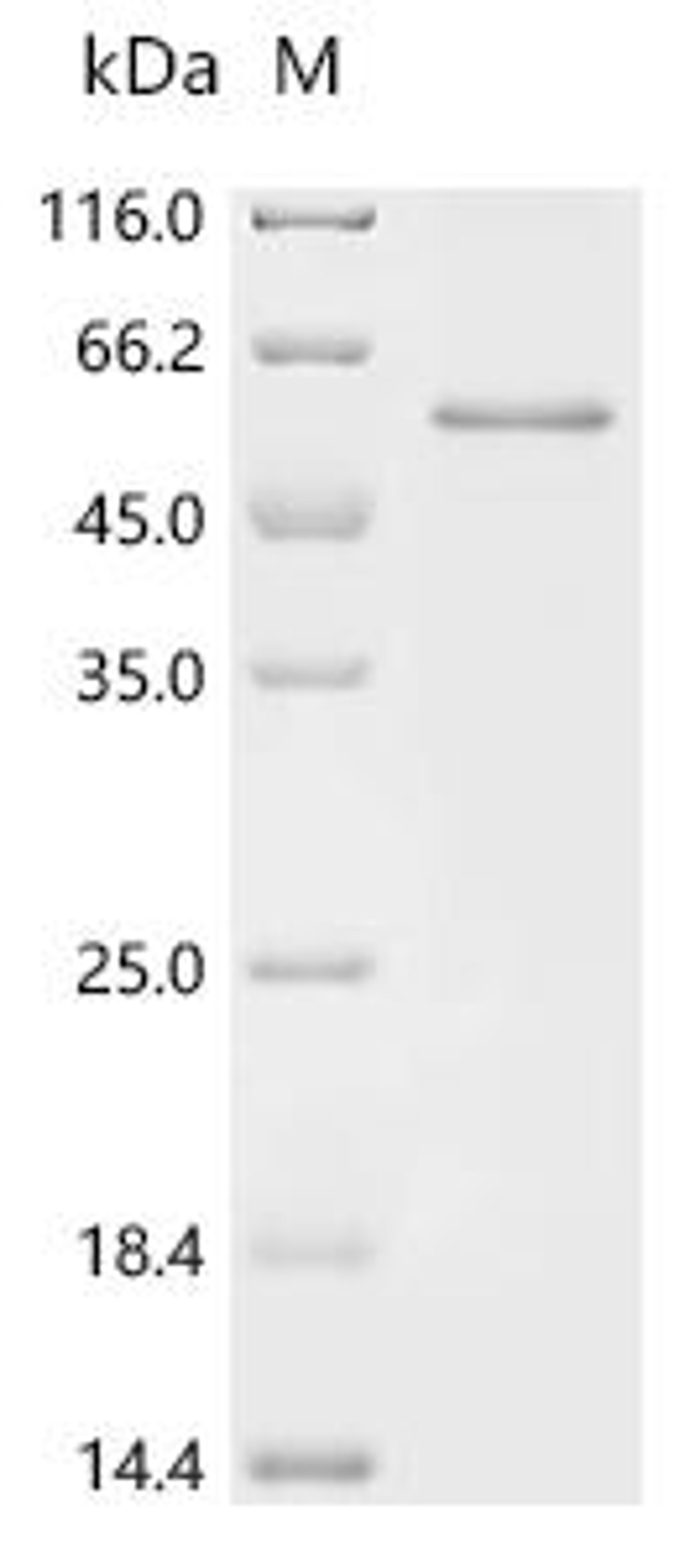 (Tris-Glycine gel) Discontinuous SDS-PAGE (reduced) with 5% enrichment gel and 15% separation gel.