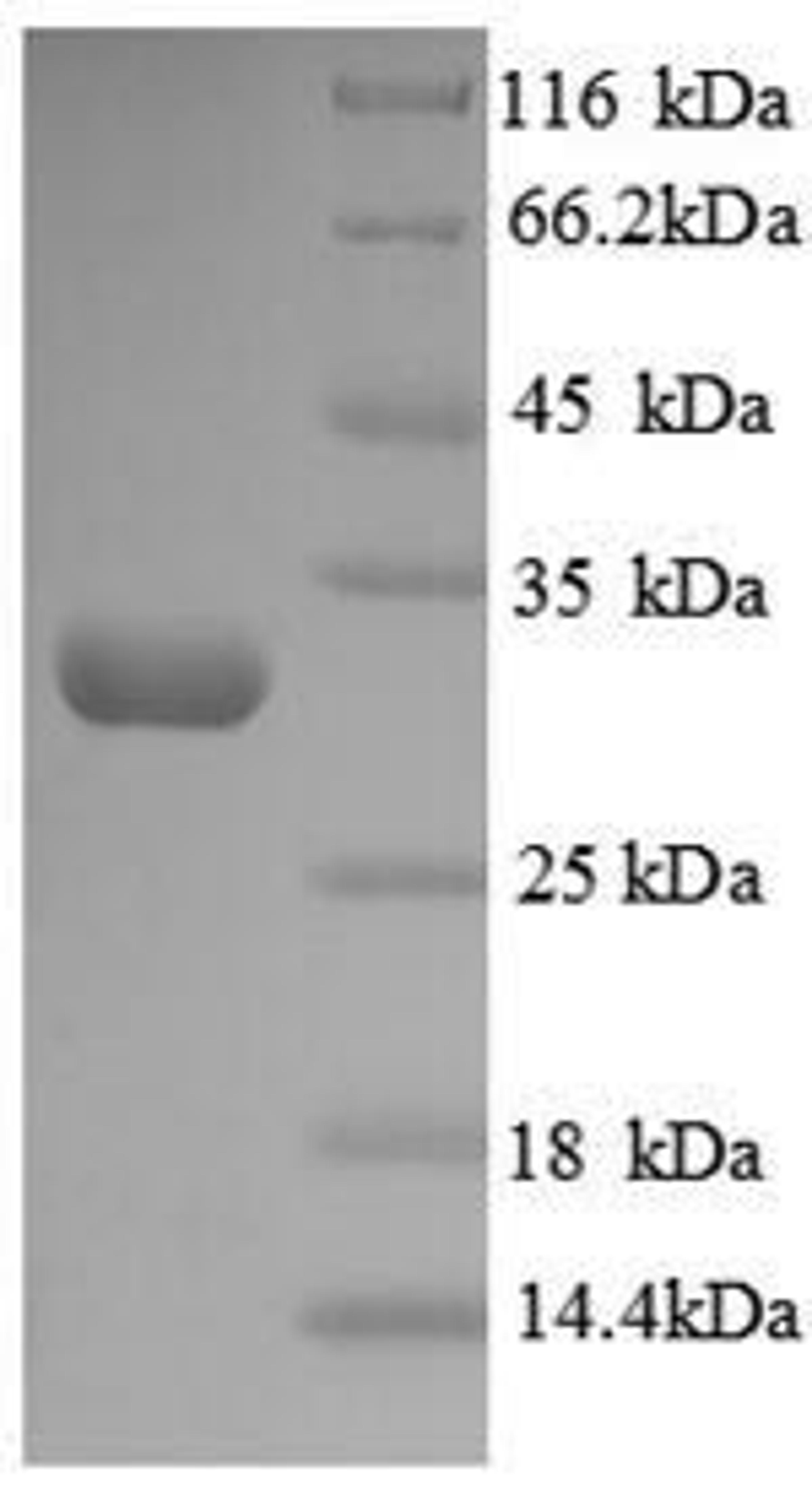 (Tris-Glycine gel) Discontinuous SDS-PAGE (reduced) with 5% enrichment gel and 15% separation gel.