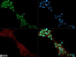 Immunocytochemistry/Immunofluorescence: JMJD1A Antibody [NBP1-49601] - JMJD1A antibody was tested in MCF-7 cells with Dylight 488 (green). Nuclei and alpha-tubulin were counterstained with DAPI (blue) and Dylight 550 (red).