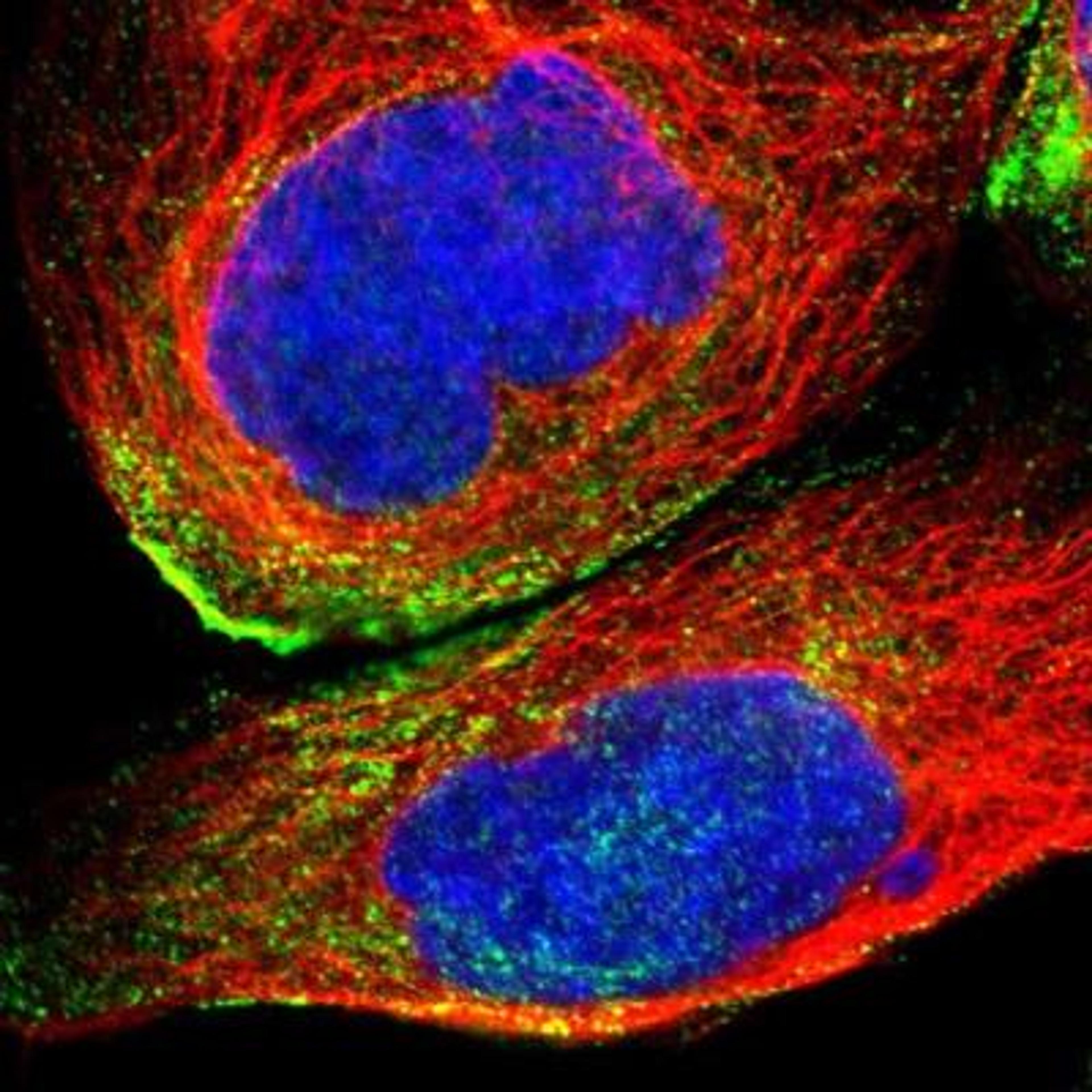 Immunocytochemistry/Immunofluorescence: TMEM43 Antibody [NBP1-84132] - Immunofluorescent staining of human cell line A-431 shows positivity in plasma membrane.