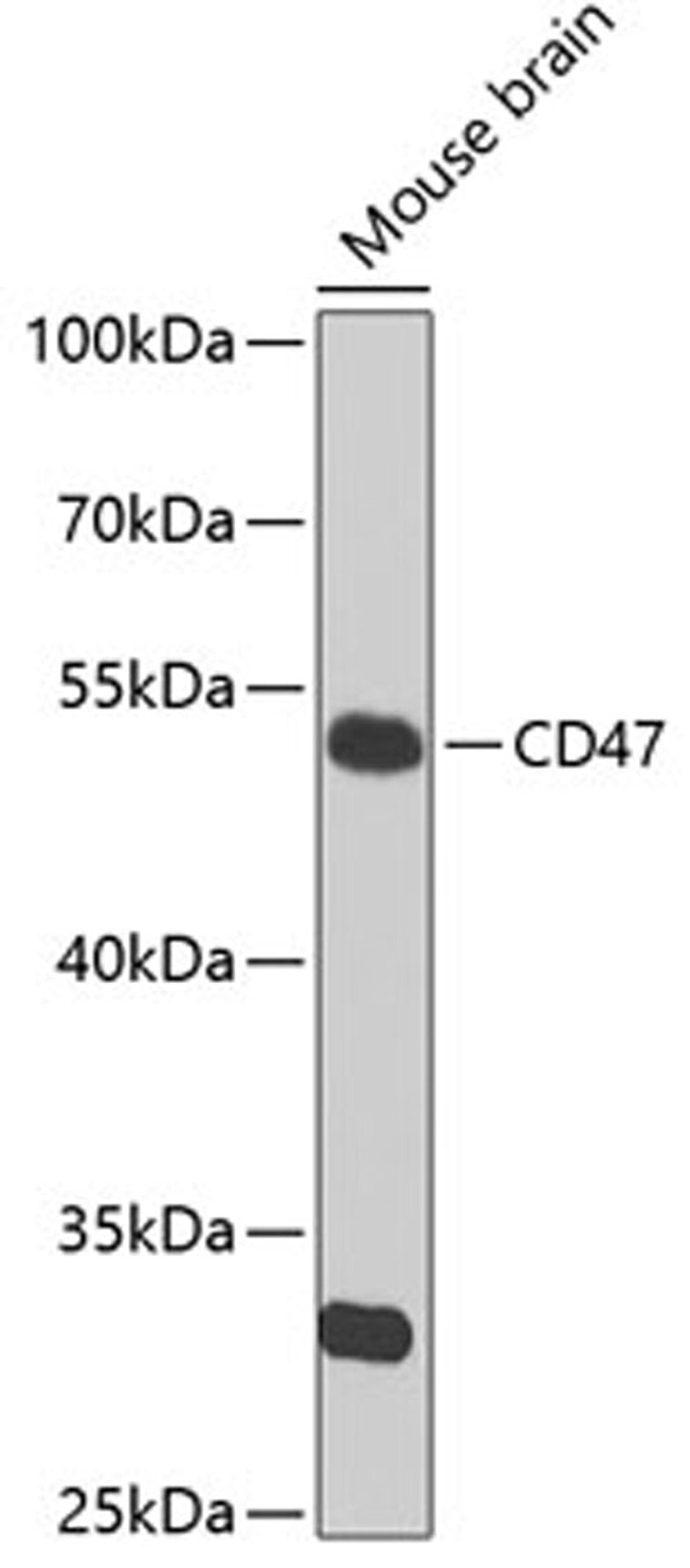 Western blot - CD47 Antibody (A7278)