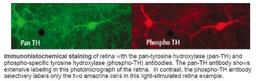 Immunohistochemistry: Tyrosine Hydroxylase [p Ser40] Antibody [NB300-173] - Immunohistochemical staining of retina with the pan-tyrosine hydroxylase (pan-TH) and phospho-specific tyrosine hydroxylase (phospho-TH) antibodies. The pan-TH antibody shows extensive labeling in this photomicrograph of the retina. In contrast, the phospho-TH antibody selectively labels only the two amacrine cells in this light-stimulated retina example.