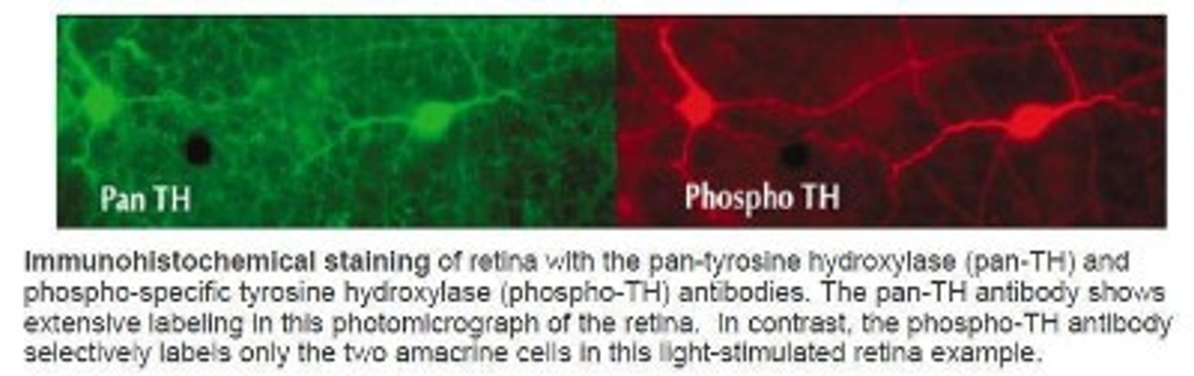 Immunohistochemistry: Tyrosine Hydroxylase [p Ser40] Antibody [NB300-173] - Immunohistochemical staining of retina with the pan-tyrosine hydroxylase (pan-TH) and phospho-specific tyrosine hydroxylase (phospho-TH) antibodies. The pan-TH antibody shows extensive labeling in this photomicrograph of the retina. In contrast, the phospho-TH antibody selectively labels only the two amacrine cells in this light-stimulated retina example.