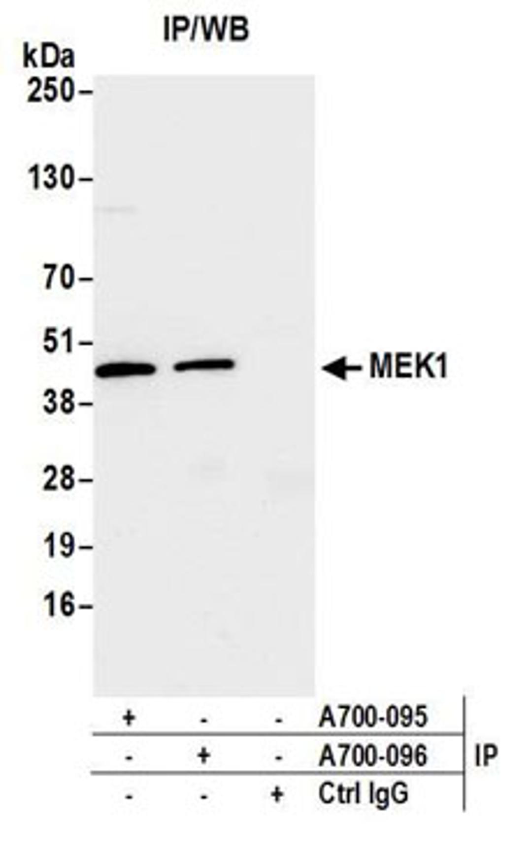 Detection of human MEK1 by western blot of immunoprecipitates.