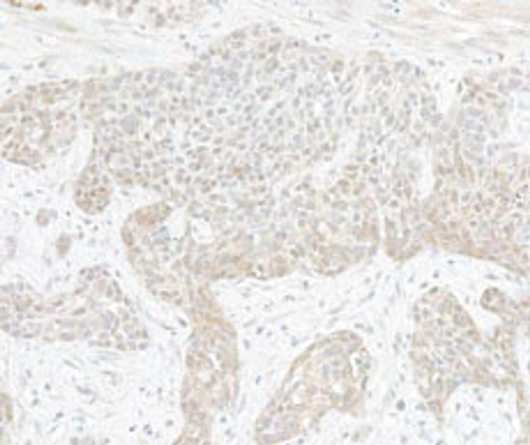 Detection of human TAF1 by immunohistochemistry.