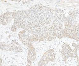 Detection of human TAF1 by immunohistochemistry.