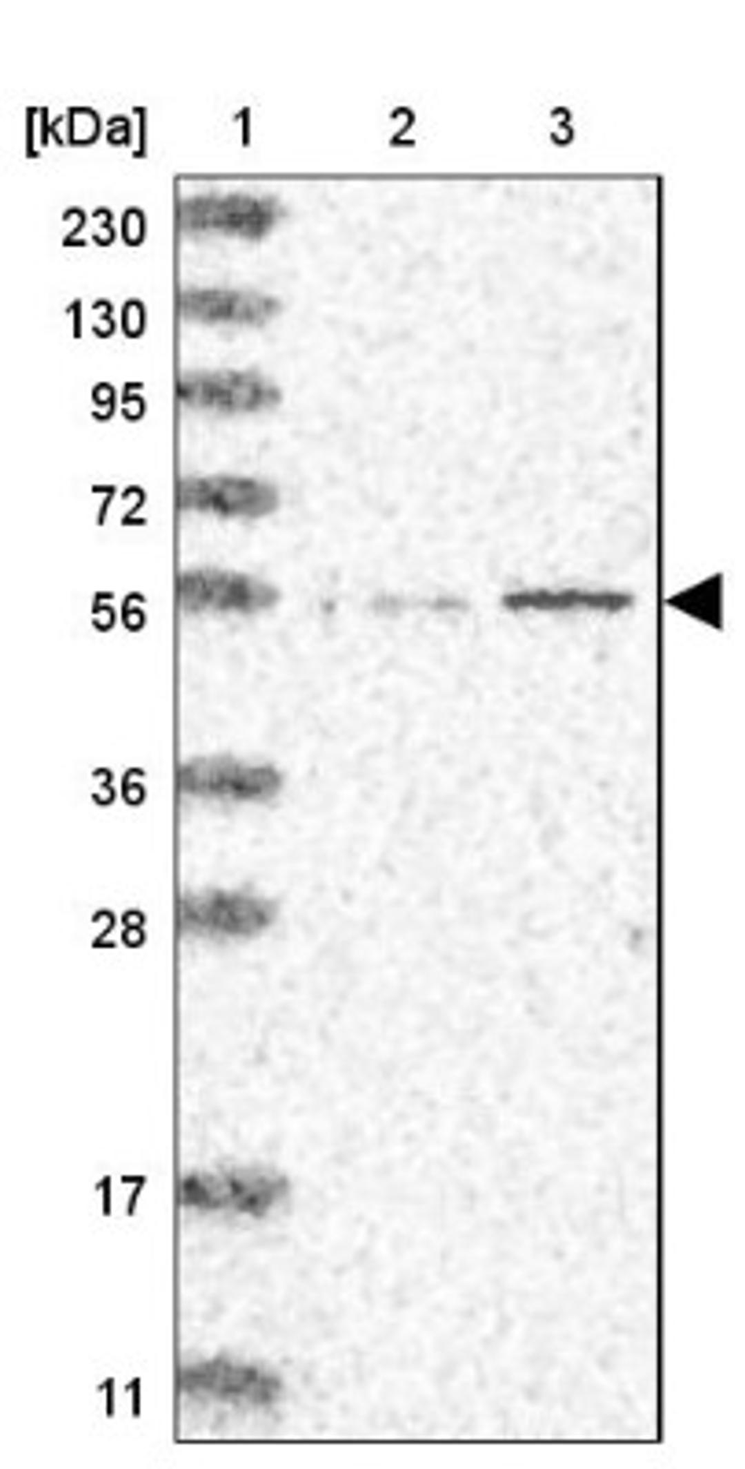 Western Blot: IQCC Antibody [NBP1-83851] - Lane 1: Marker [kDa] 230, 130, 95, 72, 56, 36, 28, 17, 11<br/>Lane 2: Human cell line RT-4<br/>Lane 3: Human cell line U-251MG sp