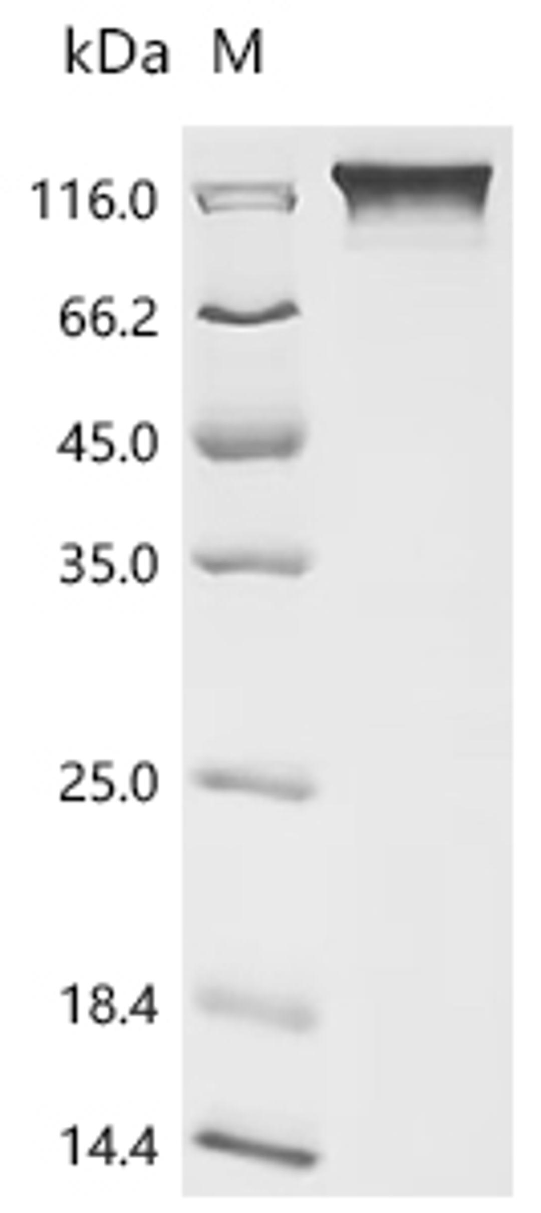 (Tris-Glycine gel) Discontinuous SDS-PAGE (reduced) with 5% enrichment gel and 15% separation gel.
