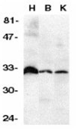 Western blot analysis of human lysates from heart, brain and kidney