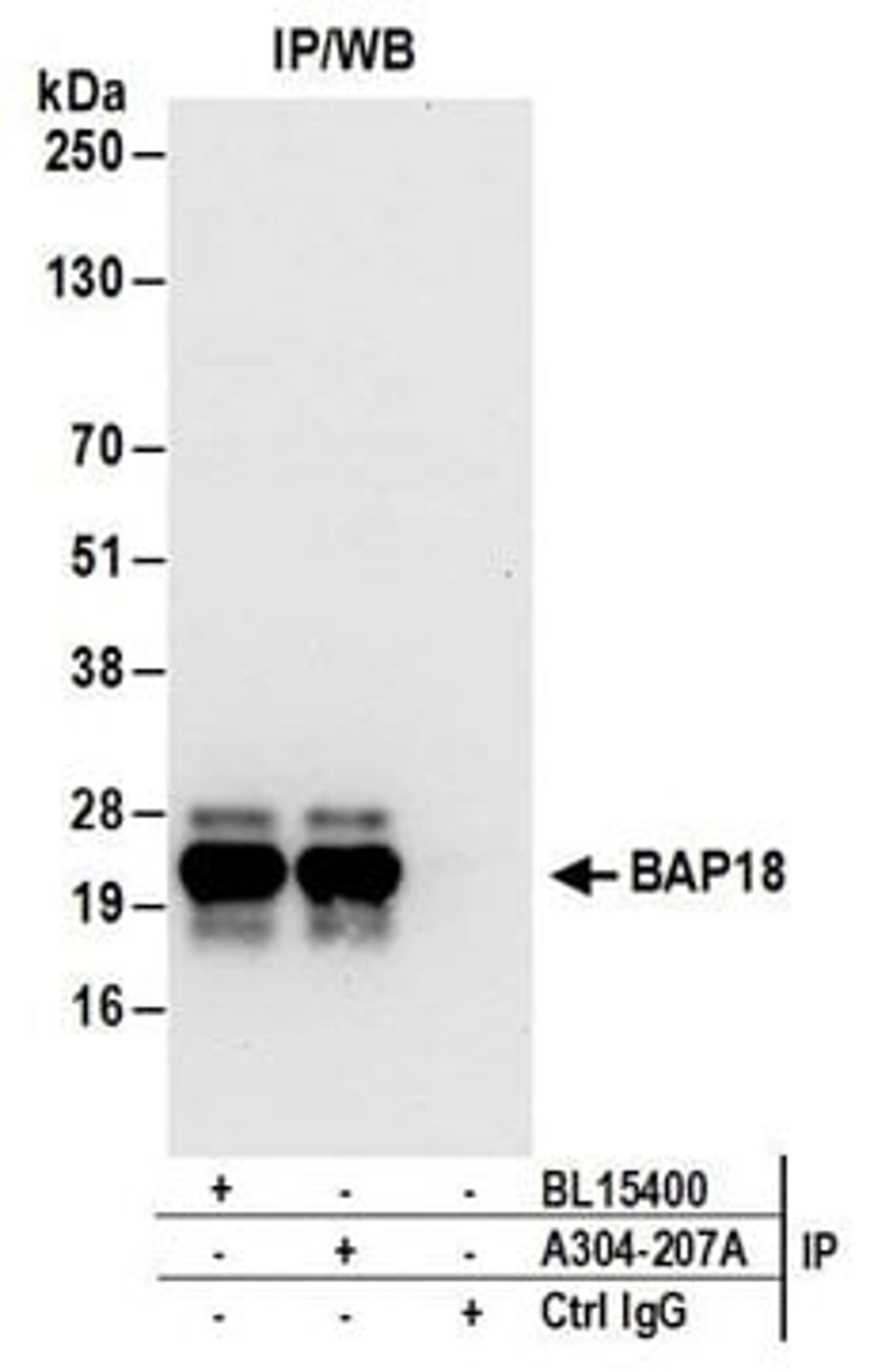 Detection of human BAP18 by western blot of immunoprecipitates.