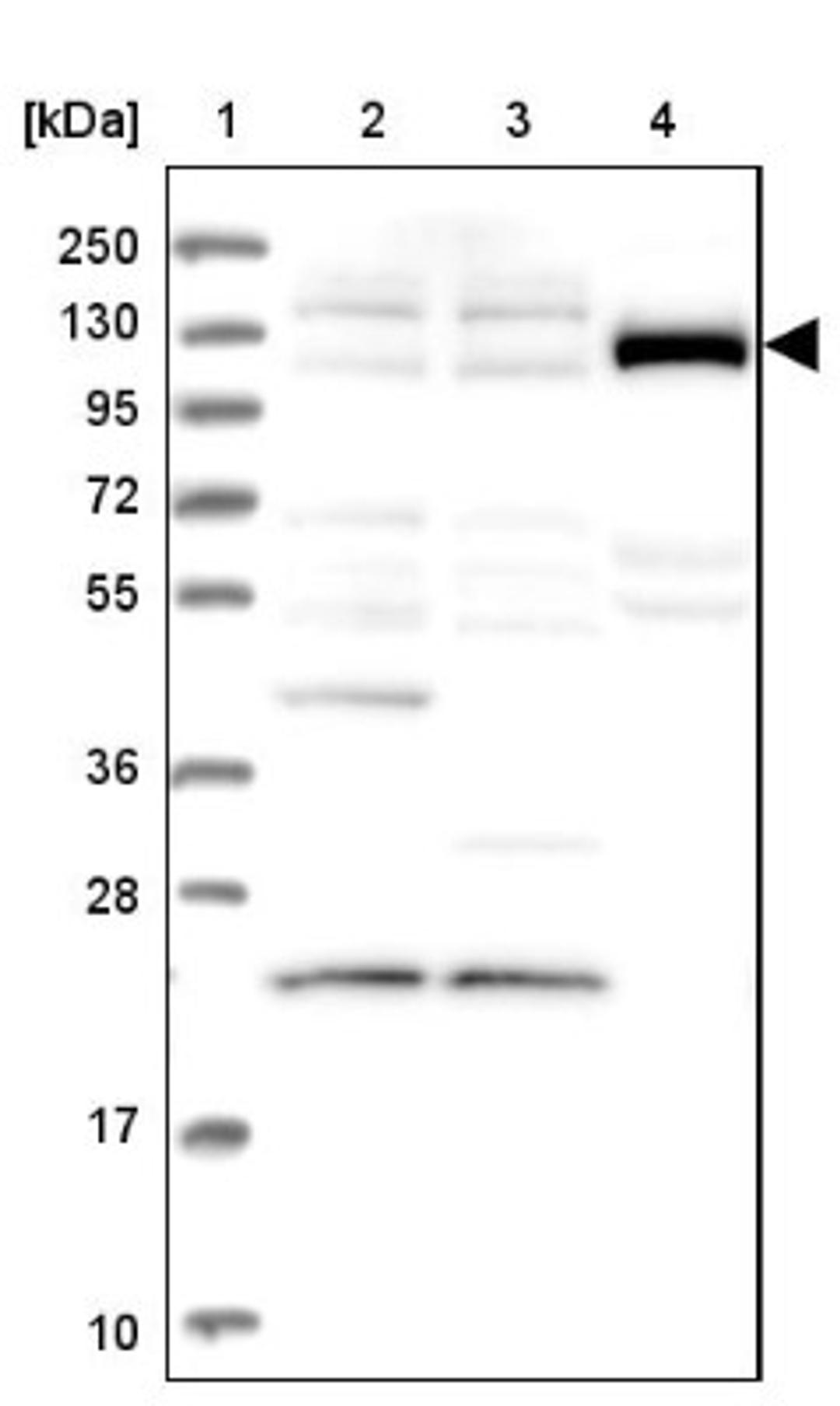 Western Blot: REXO1 Antibody [NBP1-84862] - Lane 1: Marker [kDa] 250, 130, 95, 72, 55, 36, 28, 17, 10<br/>Lane 2: Human cell line RT-4<br/>Lane 3: Human cell line U-251MG sp<br/>Lane 4: Human plasma (IgG/HSA depleted)